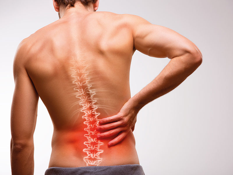 Wie können Sie feststellen, ob Rückenschmerzen muskulös oder etwas anderes sind?